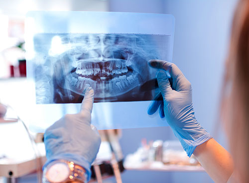 Dental complications